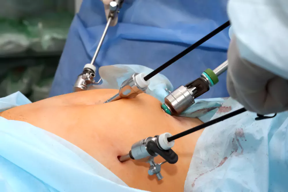 Laparoscopic Surgery